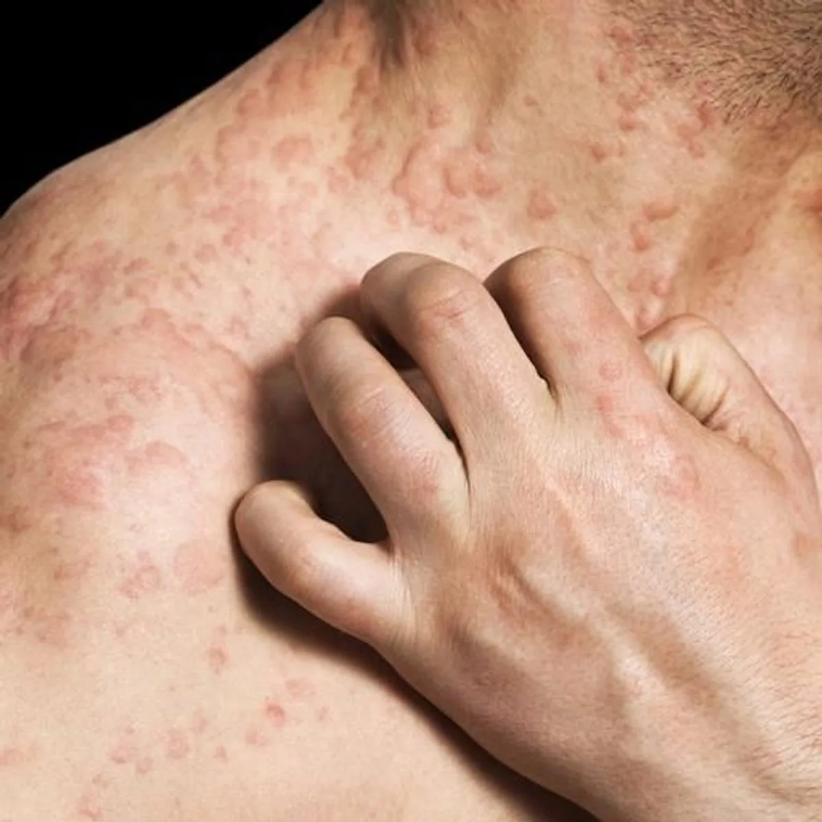Effets des produits chimiques sur la santé des agents d'entretien
